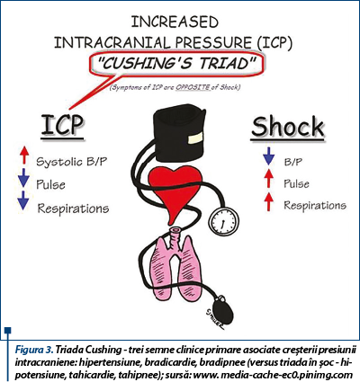 Figura 3. Triada Cushing - trei semne clinice primare asociate creșterii pre­siu­nii intracraniene: hipertensiune, bradicardie, bradipnee (versus triada în șoc - hipotensiune, tahicardie, tahipnee); sursă: www. media-cache-ec0.pinimg.com
