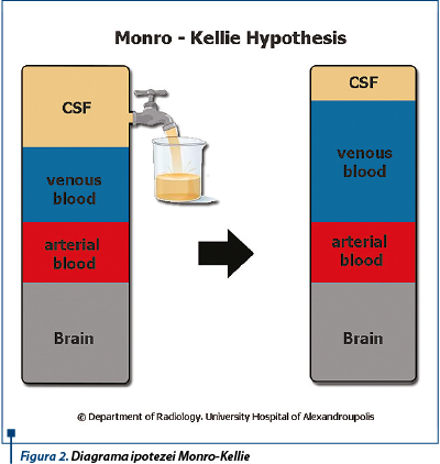 Figura 2. Diagrama ipotezei Monro-Kellie 