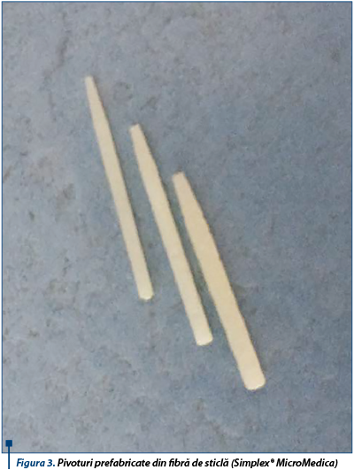 Figura 3. Pivoturi prefabricate din fibră de sticlă (Simplex® MicroMedica)