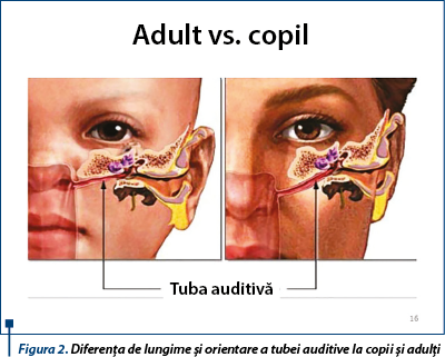 Figura 2. Diferența de lungime și orientare a tubei auditive la copii și adulți