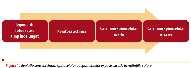 Figura 1. Figura 1. Evoluţia spre carcinom spinocelular a tegumentelor expuse excesiv la radiaţiile solare