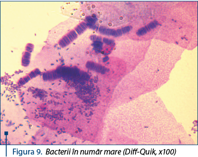 Figura 9. Bacterii în număr mare (Diff-Quik, x100) 