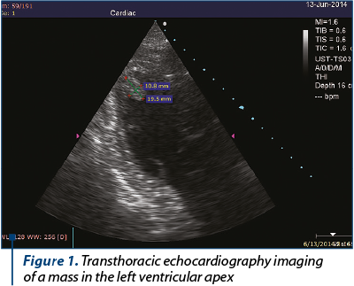 Figure 1. Transthoracic echocardiography imaging 