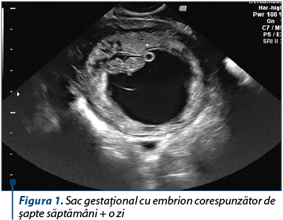 Figura 1. Sac gestaţional cu embrion corespunzător de şapte săptămâni + o zi