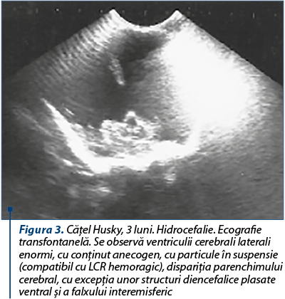 Figura 3. Căţel Husky, 3 luni. Hidrocefalie. Ecografie transfontanelă. Se observă ventriculii cerebrali laterali enormi, cu conţinut anecogen, cu particule în suspensie (compatibil cu LCR hemoragic), dispariţia parenchimului cerebral, cu excepţia unor structuri diencefalice plasate ventral şi a falxului interemisferic
