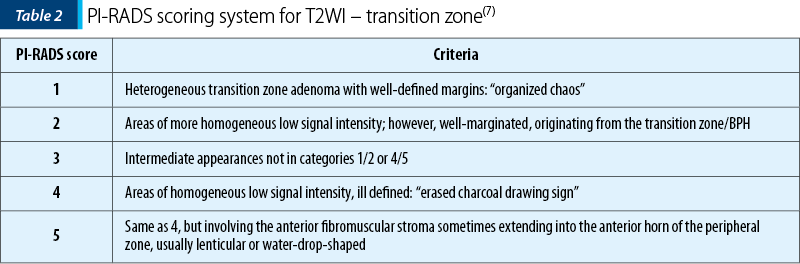 Table 2. PI-RADS scoring system for T2WI – transition zone(7)