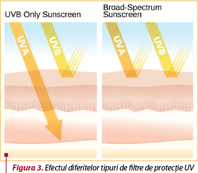Figura 3. Efectul diferitelor tipuri de filtre de protecţie UV