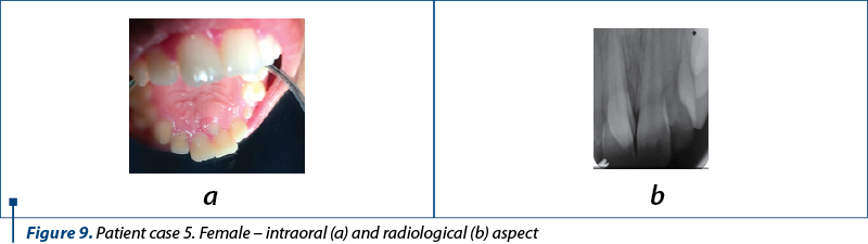 Figure 9. Patient case 5. Female – intraoral (a) and radiological (b) aspect