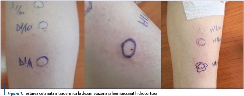 Figura 1. Testarea cutanată intradermică la dexametazonă şi hemisuccinat hidrocortizon