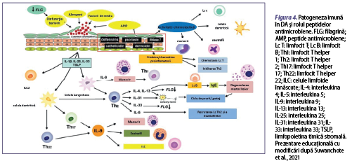 Figura 4. Patogeneza imună în DA şi rolul peptidelor antimicrobiene. FLG: filagrină; AMP, peptide antimicrobiene; Lc T: limfocit T; Lc B: limfocit B; Th1: limfocit T helper 1; Th2: limfocit T helper 2; Th17: limfocit T helper 17; Th22: limfocit T helper 22; ILC: celule limfoide înnăscute; IL-4: interleukina 4; IL-5: interleukina 5; IL-9: interleukina 9; IL-13: interleukina 13; IL-25: interleukina 25; IL-31: interleukina 31; IL-33: interleukina 33; TSLP, limfopoietina timică stromală. Prezentare educaţională cu modificări după Suwanchote et al., 2021