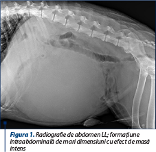 Figura 1. Radiografie de abdomen LL; formaţiune intraabdominală de mari dimensiuni cu efect de masă intens